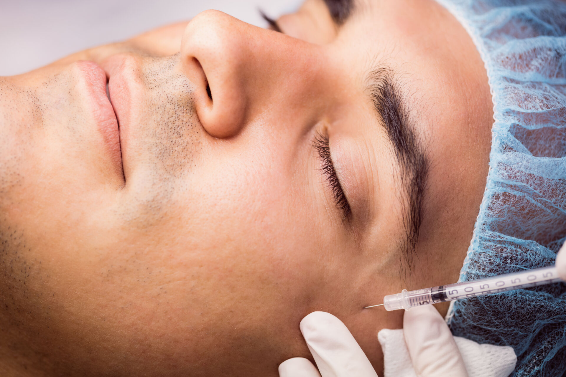 Mesotherapy by DentoBeauty